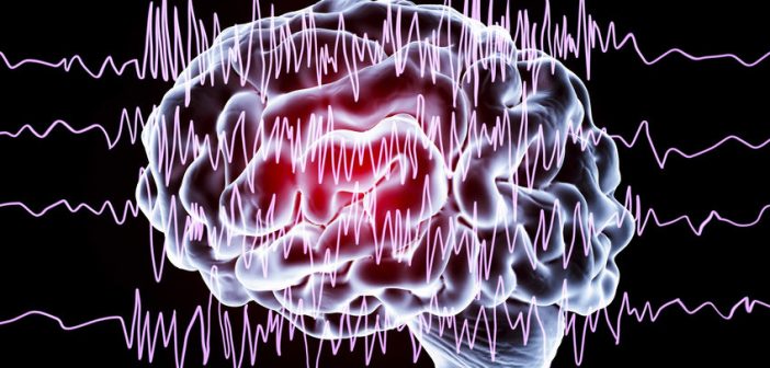 National Epilepsy Month